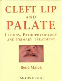 Cleft Lip and Palate: Lesions, Pathophysiology and Primary Treatment (Hardcover)