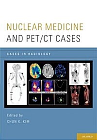 Nuclear Medicine and Pet/CT Cases (Paperback)