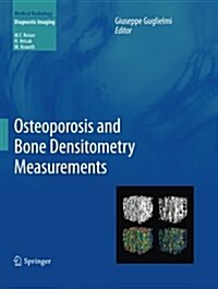 Osteoporosis and Bone Densitometry Measurements (Paperback, 2013)