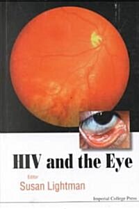 HIV And the Eye (Hardcover)