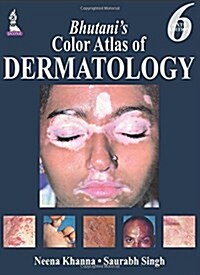 Bhutanis Color Atlas of Dermatology (Hardcover, 6, UK)