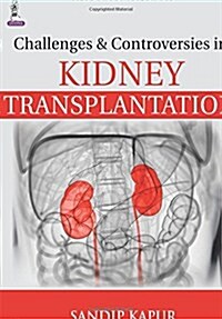 Challenges and Controversies in Kidney Transplantation (Hardcover)