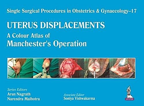 Uterus Displacements (Hardcover)