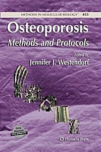 Osteoporosis: Methods and Protocols (Paperback, 2008)