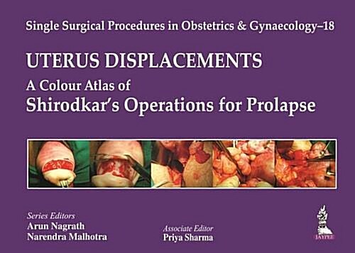 Uterus: Displacements (Hardcover, 1st)