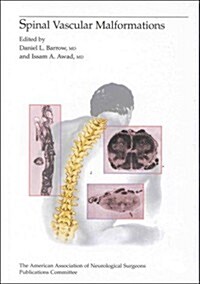 Spinal Vascular Malformations (Hardcover)