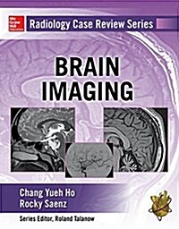 Radiology Case Review Series: Brain Imaging (Paperback, UK)