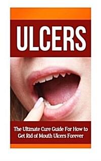 Ulcers: The Ultimate Cure Guide for How to Get Rid of Mouth Ulcers Instantly (Paperback)