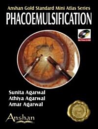  Phacoemulsification (Paperback, 1st, Mini, PCK)