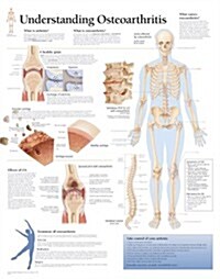 Understanding Osteoarthritis Chart: Laminated Wall Chart (Other)