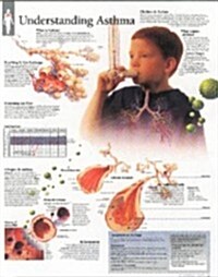 Understanding Asthma Chart: Wall Chart (Other)