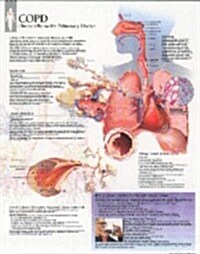 Copd Chart: Laminated Wall Chart: Laminated Wall Chart (Other)