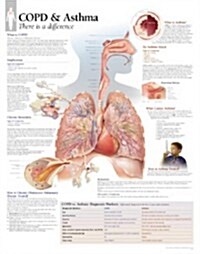 Copd/Asthma Chart: Wall Chart (Other)