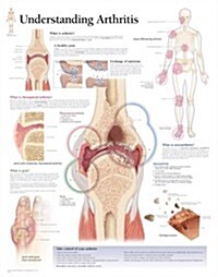 Understanding Arthritis Chart: Laminated Wall Chart (Other)