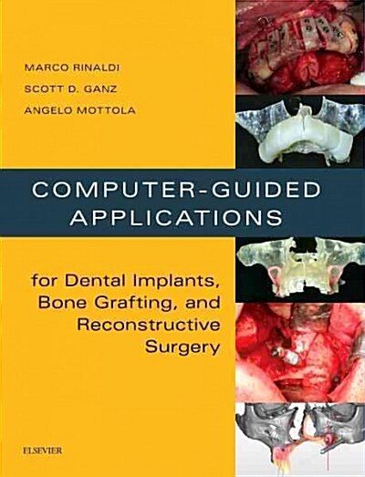 Computer-Guided Applications for Dental Implants, Bone Grafting, and Reconstructive Surgery (Adapted Translation) (Hardcover)