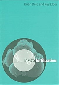 In Vitro Fertilization (Paperback)