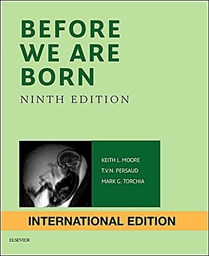 Before We are Born : Essentials of Embryology and Birth Defects (Paperback, 9 International ed)