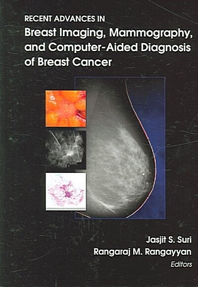Recent Advances in Breast Imaging, Mammography, And Computer-Aided Diagnosis of Breast Cancer (Hardcover, Compact Disc)