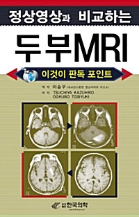 [중고] 정상영상과 비교하는 두부 MRI