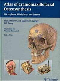 Atlas of Craniomaxillofacial Osteosynthesis: Microplates, Miniplates, and Screws (Hardcover, 2)