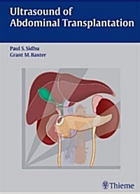Ultrasound of Abdominal Transplantation (Hardcover)