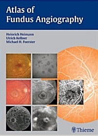 Atlas of Fundus Angiography (Hardcover)