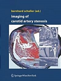 Imaging of Carotid Artery Stenosis (Hardcover)