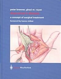 Dupuytrens Disease: A Concept of Surgical Treatment (Hardcover, 2003)