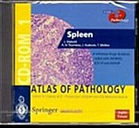 Spleen (Paperback, CD-ROM)