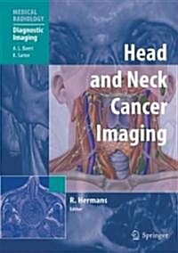 Head and Neck Cancer Imaging (Hardcover)