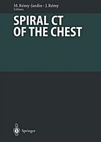Spiral CT of the Chest (Hardcover)