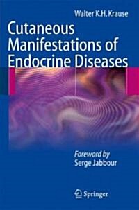 Cutaneous Manifestations of Endocrine Diseases (Hardcover, 2009)