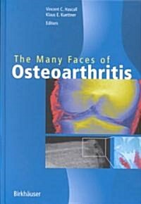 The Many Faces of Osteoarthritis (Hardcover)