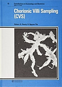 Chorionic Villi Sampling (Hardcover)