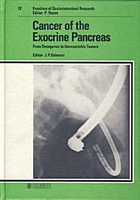 Cancer of the Exocrine Pancreas (Hardcover)