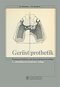 Geruestprothetik (Paperback, 2nd, Revised)