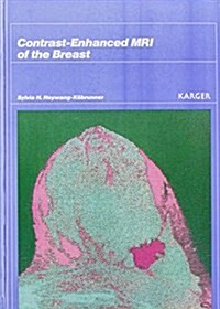 Contrast-Enhanced Mri of the Breast (Hardcover)