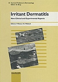 Irritant Dermatitis (Hardcover)