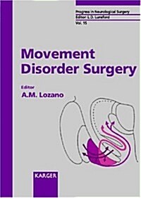 Movement Disorder Surgery (Hardcover)