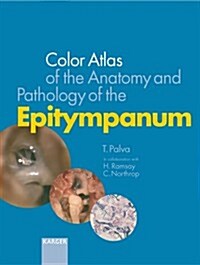 Colour Atlas of the Anatomy and Pathology of the Epitympanum (Hardcover)
