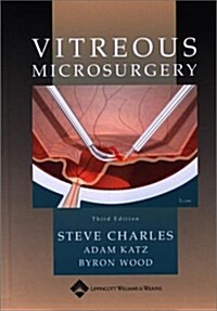 Vitreous Microsurgery (Hardcover, 3 Rev ed)