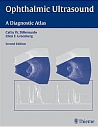 Ophthalmic Ultrasound : A Diagnostic Atlas (Hardcover, 2 Rev ed)