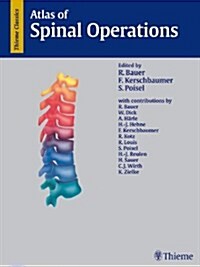 Atlas of Spinal Operations (Hardcover)
