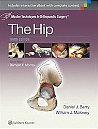 Master Techniques in Orthopaedic Surgery: The Hip (Hardcover, 3)