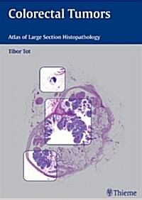 Histopathology of Colorectal Tumors (Hardcover)