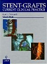 Stent-grafts : Current Clinical Practice (Hardcover)