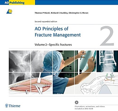 AO Principles of Fracture Management (Paperback + Audio CD, Rev ed)