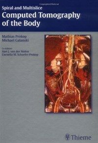 Spiral and multislice computed tomography of the body