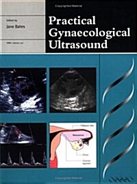 Practical Gynaecological Ultrasound (Paperback, Rev ed)