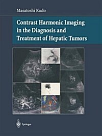 Contrast Harmonic Imaging in the Diagnosis and Treatment of Hepatic Tumors (Hardcover)
